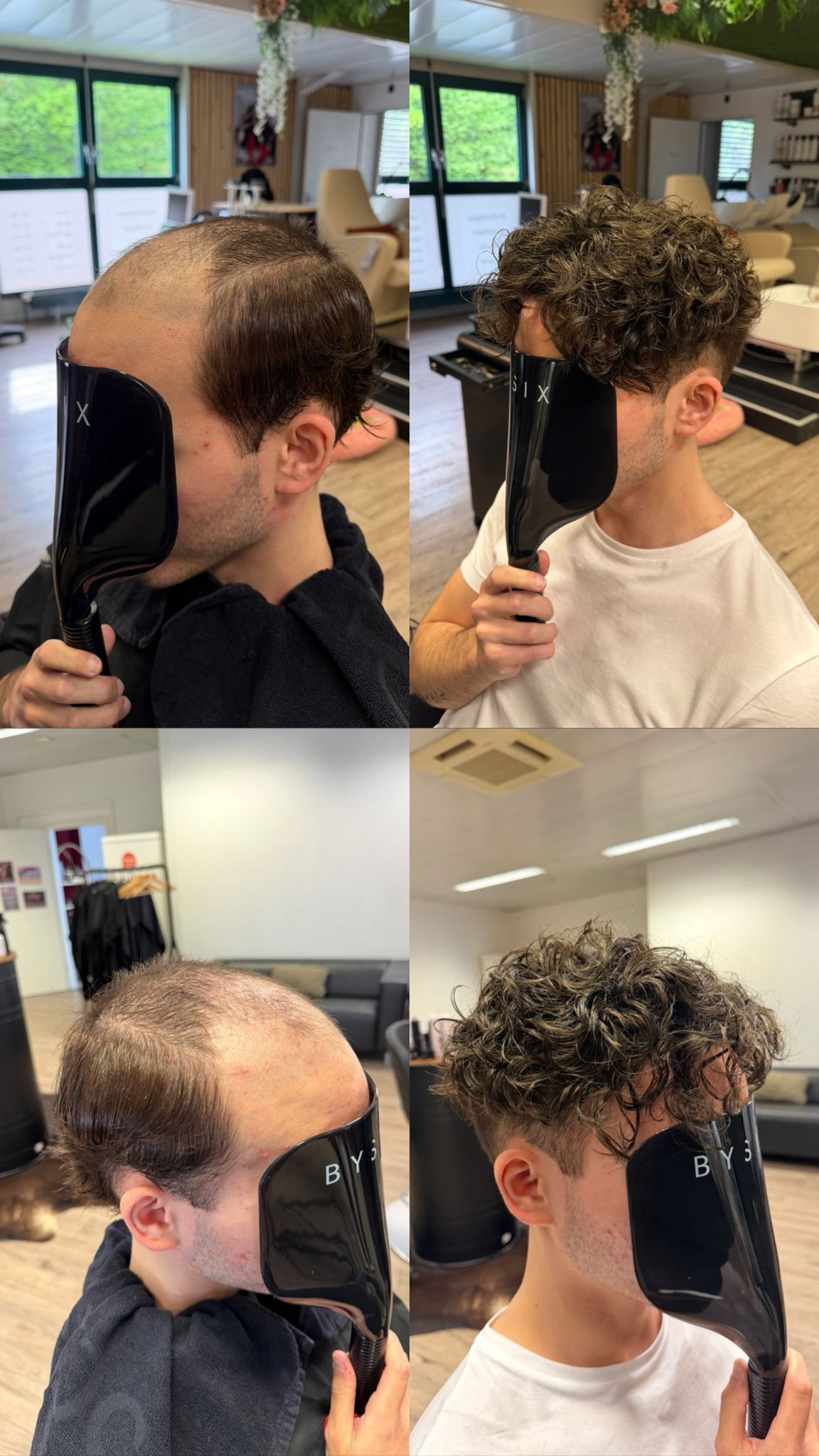 Complément capillaire BySix — avant/après : implantation capillaire homme, résultat naturel par Shana au Beauty Studio Lutry