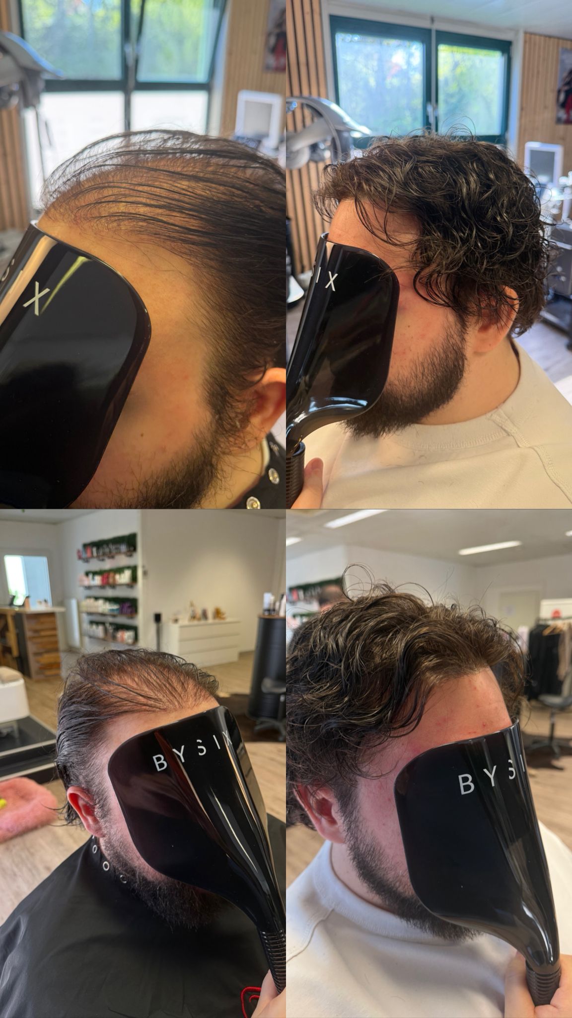 Complément capillaire BySix — avant/après : densité retrouvée, transformation capillaire homme au Beauty Studio Lutry